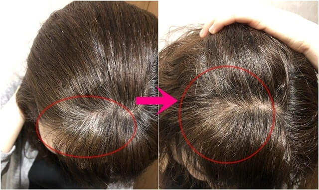 マイナチュレを使う前と後の髪の色比較